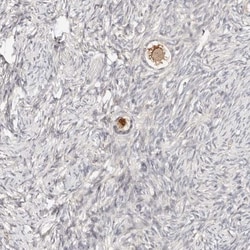 ZRANB1/Trabid Antibody, Novus Biologicals 0.1mL; Unlabeled:Antibodies,